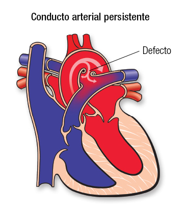 PDA SP